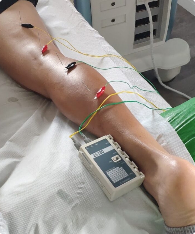 Neuromodulación 1 - Aj Physio